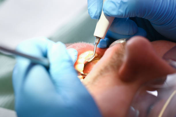Best Broken or Cracked Tooth Emergency Dentist in Winton, CA
